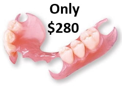 Upper affordable  flexible denture, flipper, removable denture, upper partial, lower partial, low price flexible dentures, low price dental lab, flexible partials