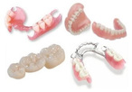 Upper affordable  flexible denture, flipper, removable denture, upper partial, lower partial, low price flexible dentures, low price dental lab, flexible partials